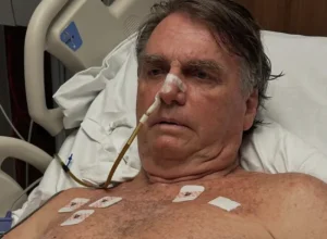 jair-bolsonaro-internado-cirurgia-20abr2025-848x477-1-png